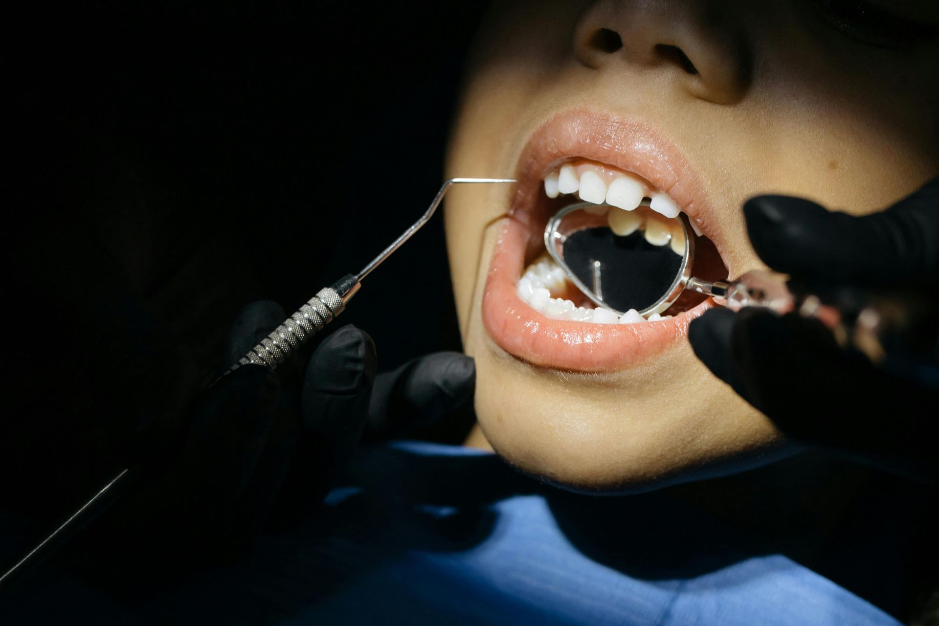 Person's mouth open during dental exam, with tools in use and mirror reflecting teeth.