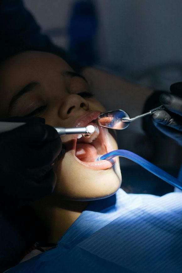 Person in dentist chair, mouth open, receiving dental work. Bright light, tools visible.