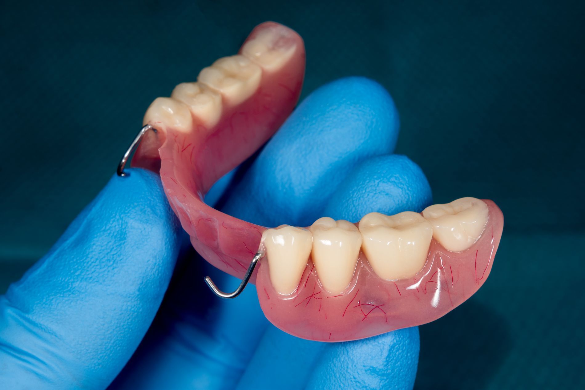 Partial dentures held by a gloved hand. The pink plastic base has attached artificial teeth.