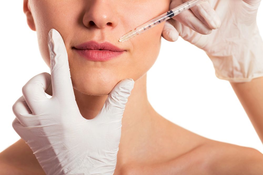 dermal filler application