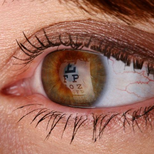 Eye with a Snellen chart reflected in the pupil, indicating an eye exam.