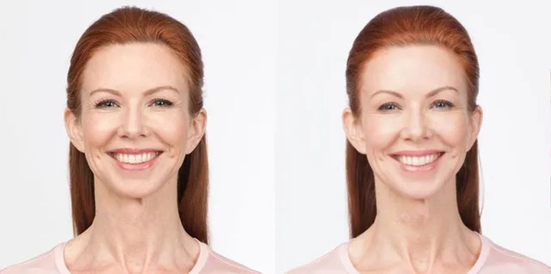 Two women with red hair smiling, side by side, possibly a before and after photo.