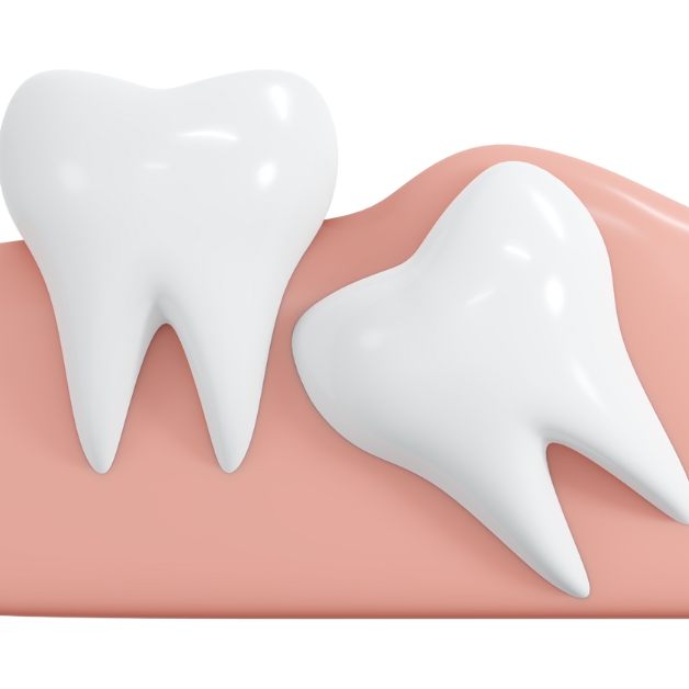 Wisdom Teeth Removal Merrillville, IN