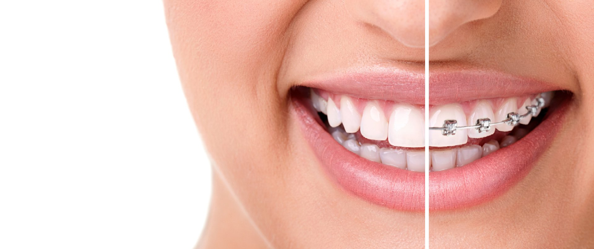 Orthodontic Services