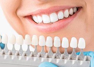 Dentist — Smiling Person with Shades of Tooth Implants in Colorado springs, CO