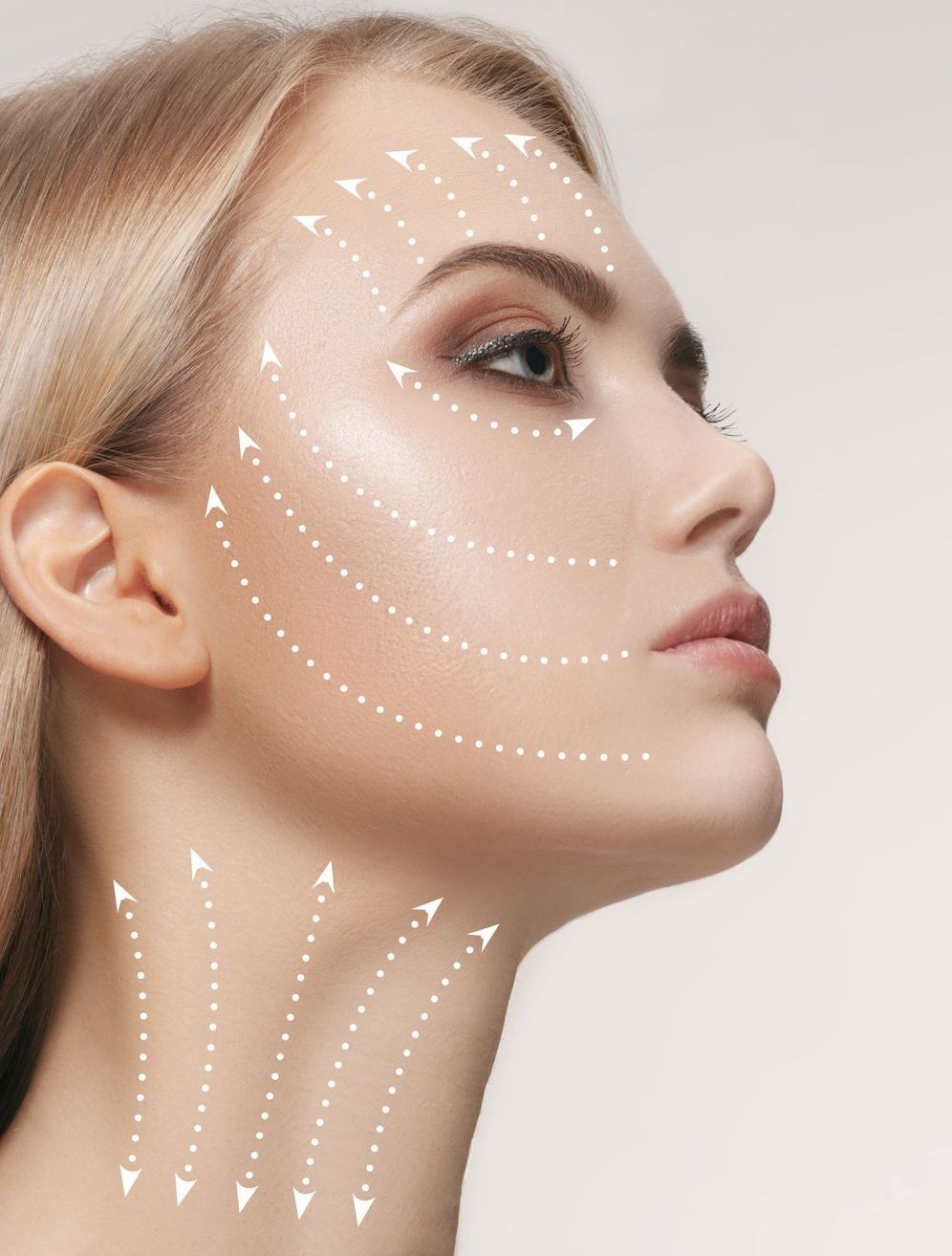 Woman's face with marked arrows indicating a facelift. Side profile, blonde hair, light background.