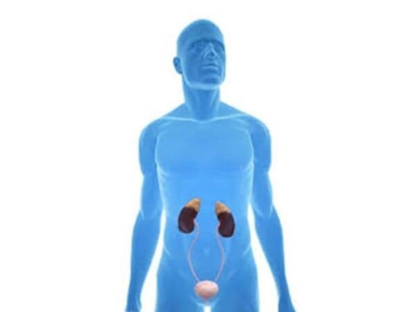 DR. GERARDO GARFIAS CHÁVEZ URÓLOGO - Litotripsia