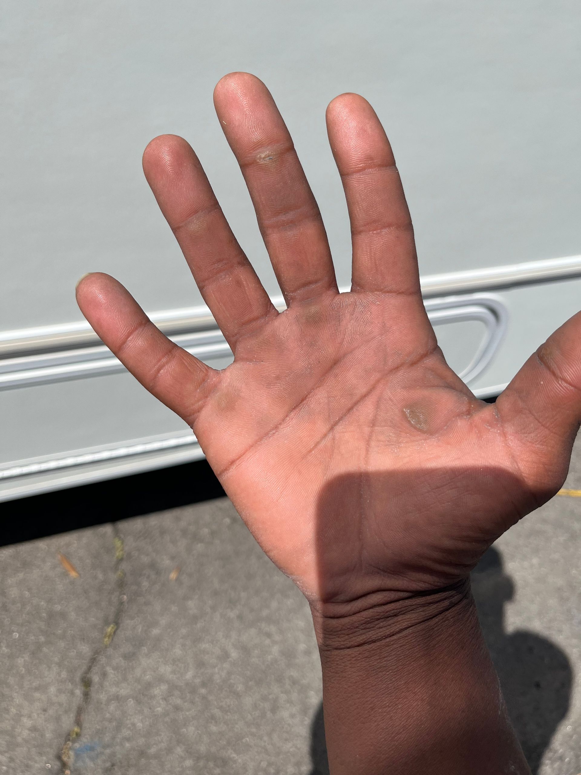 A close up of a person 's hand with a car in the background