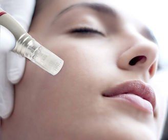 Dermaplane - Denver, CO