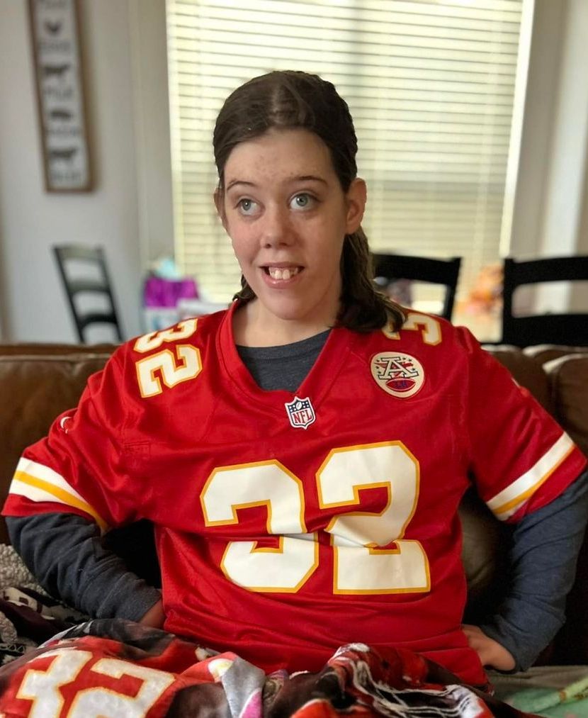 Alexa Xq27-q28 deletion