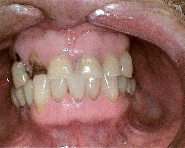 dental implants rancho cucamonga