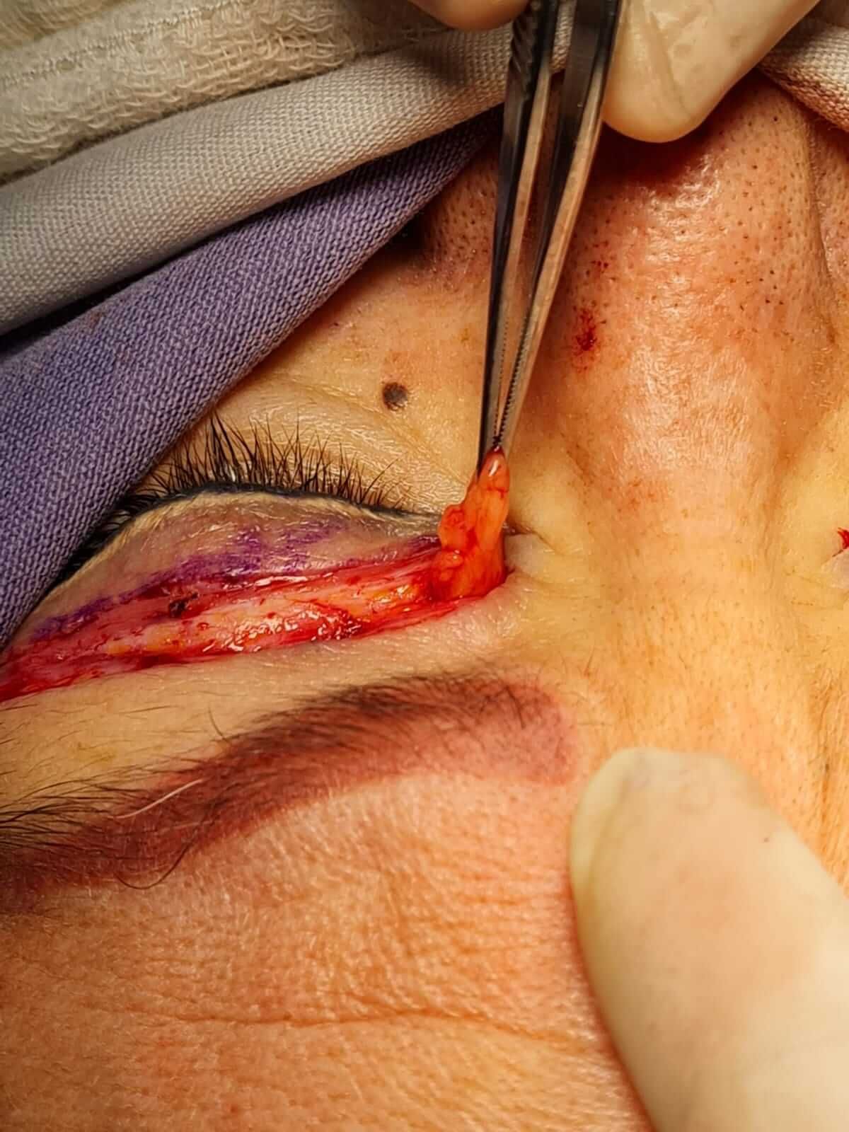 DR. CAMERINO ENRIQUE MORENO ORTEGA