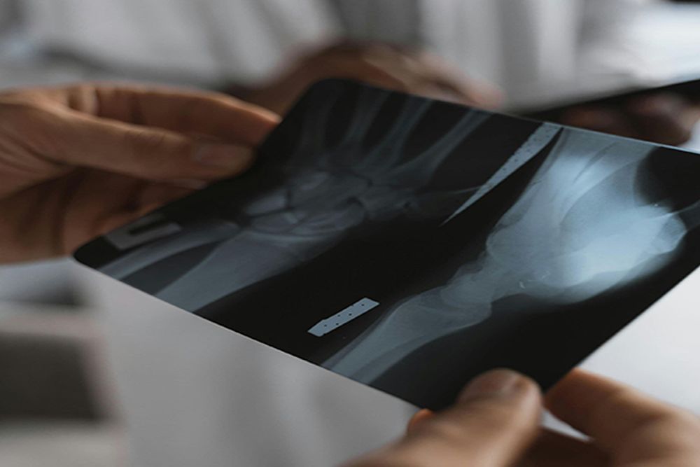 A Person Is Holding an X-Ray of Their Hand and Knee — Burwood Back Pain in Strathfield, NSW