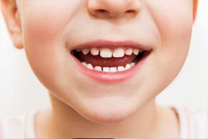 Healthy Teeth For Children —Little Boy Smiling  in Rohnert Park, CA