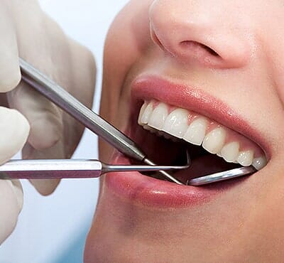 Examining Mouth—Cosmetic Dentistry in Fillmore, CA