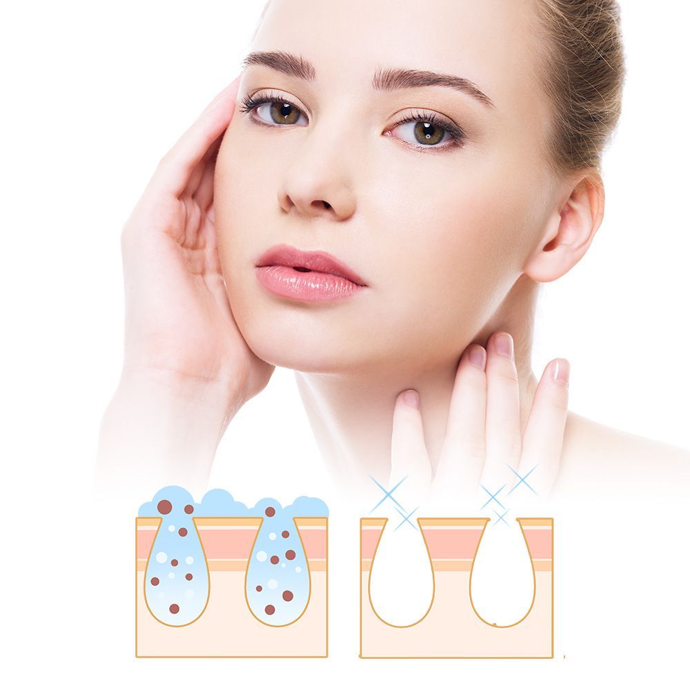 一位女士正在用手撫摸她的臉，旁邊是一位長有粉刺的女士臉部圖。