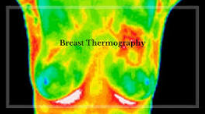 A breast thermography scan showing heat patterns with red and orange areas indicating higher temperatures.