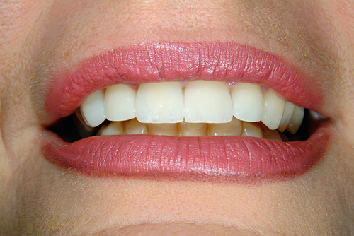 A close up of a woman 's mouth with white teeth and pink lips.