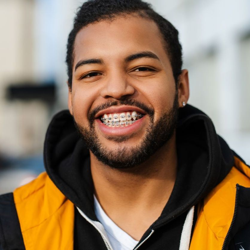 A man with braces on his teeth smiles for the camera