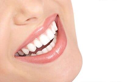 DIENTE FELIZ-Limpieza bucal