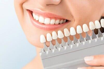 DIENTE FELIZ-Implantes