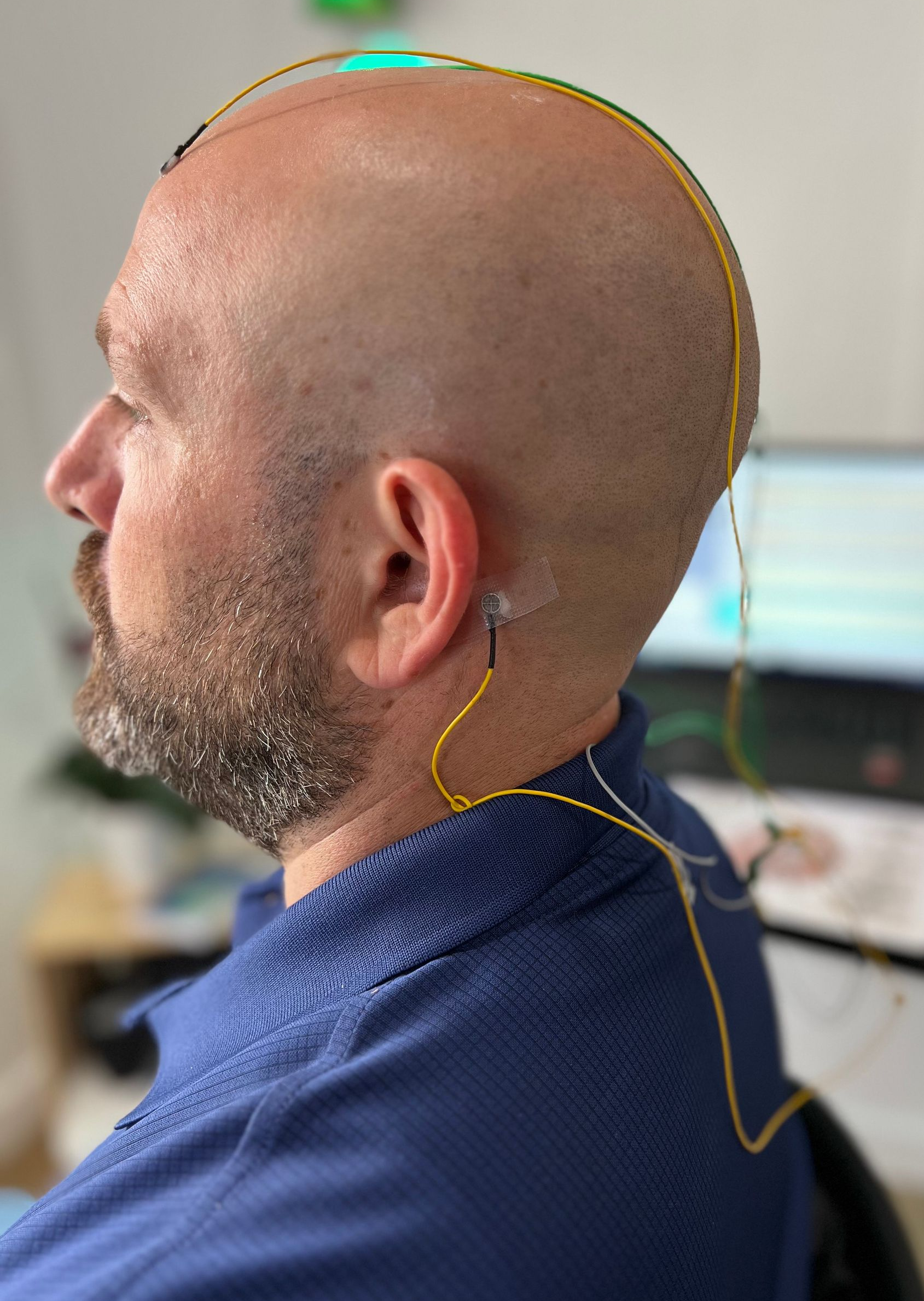 A woman with electrodes on her head is seated in front of a laptop displaying data. She is wearing a blue shirt, likely undergoing a medical exam.