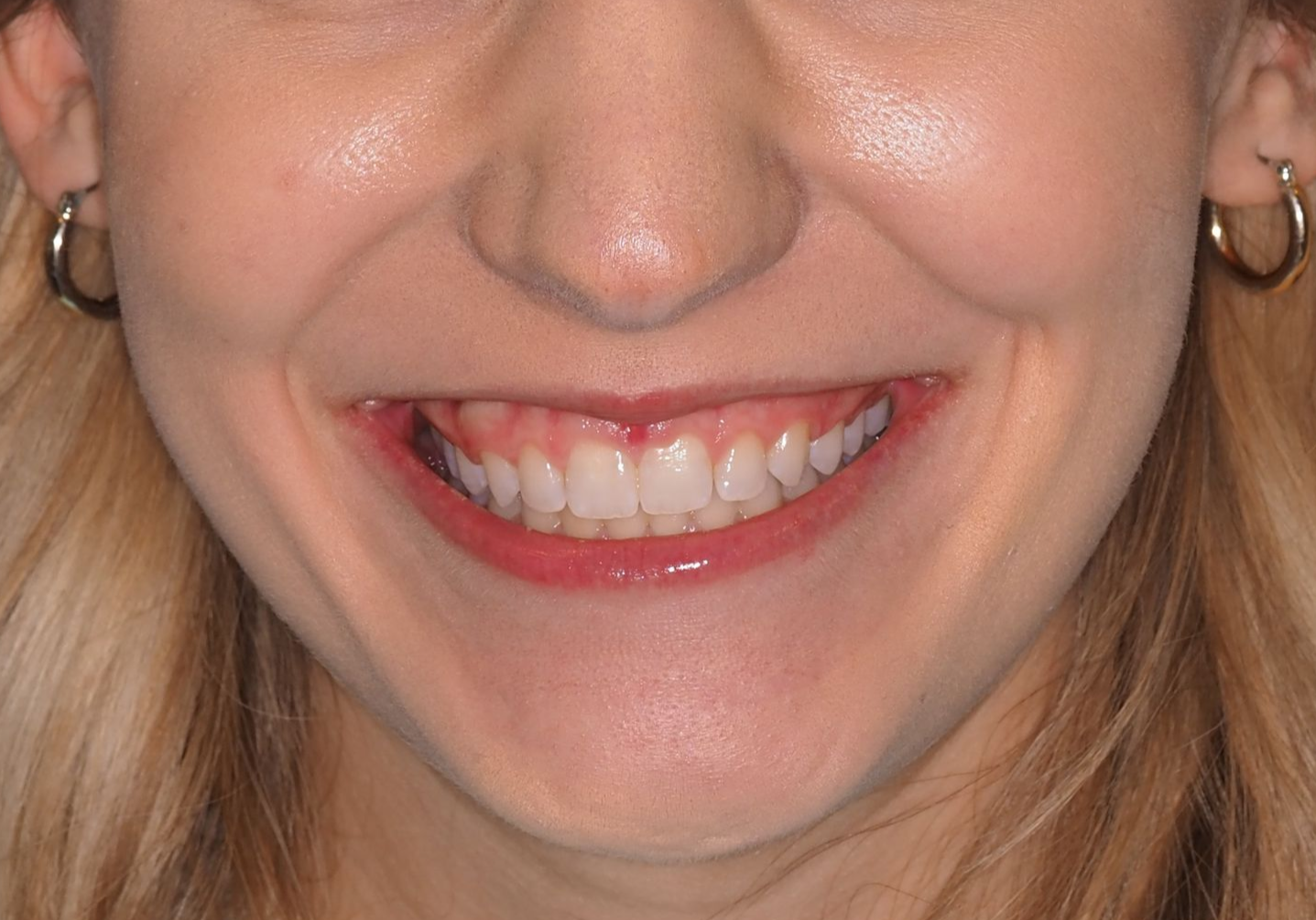 Close-up of a smiling person's face. White teeth, red lipstick, hoop earrings, fair skin.