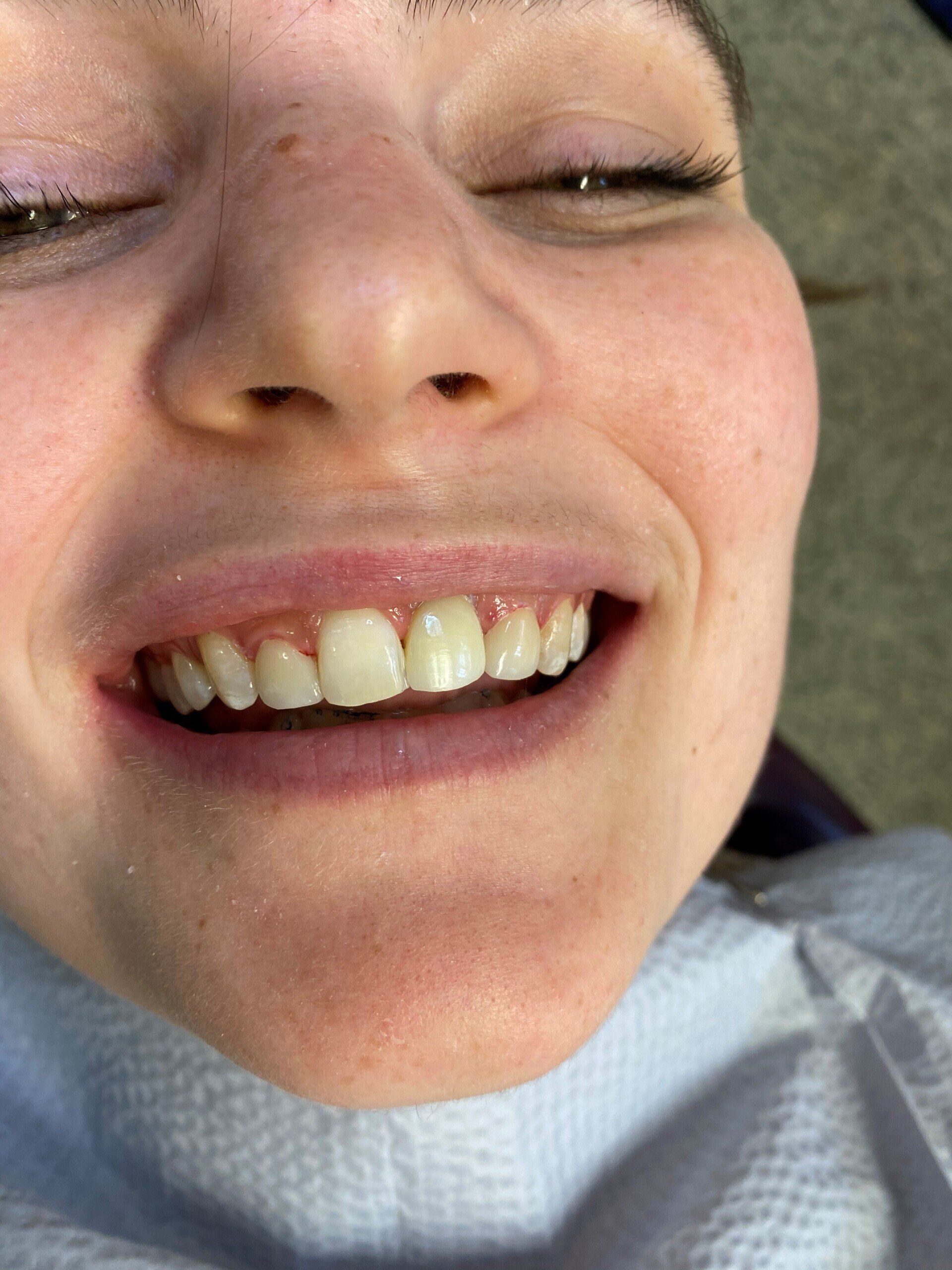 After image of patient 2 — Washington, DC — Michael G. Landy, DDS.