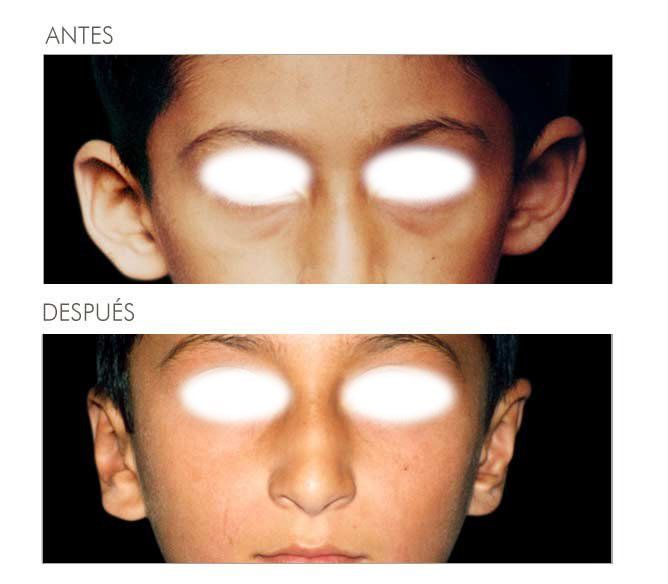 A before and after picture of a child 's face