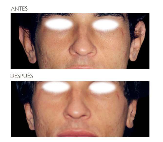 A before and after photo of a man 's face