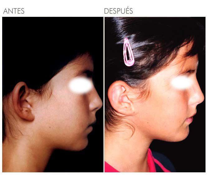 A before and after photo of a girl 's face