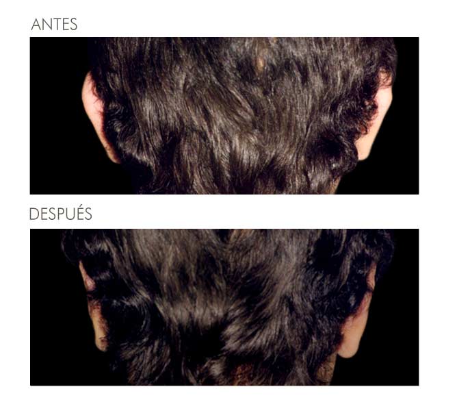 A before and after picture of a man 's hair.