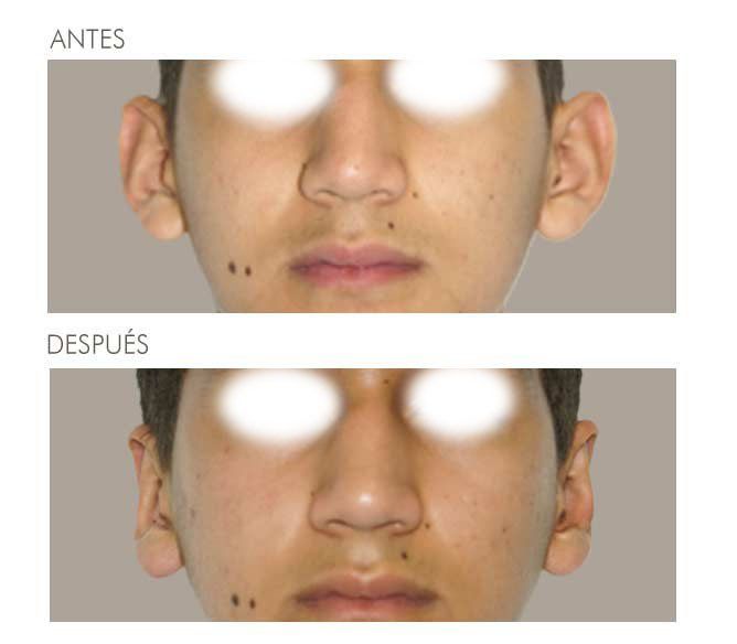 A before and after picture of a man 's face