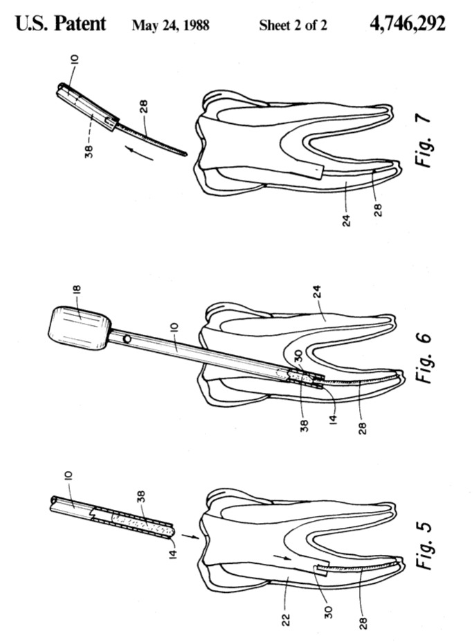 Patent usoo4746292 figures 5-7