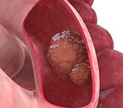 Dr. Jesús Wilfrido Zazueta Gómez