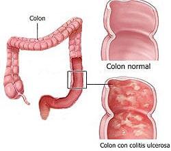 Dr. Jesús Wilfrido Zazueta Gómez