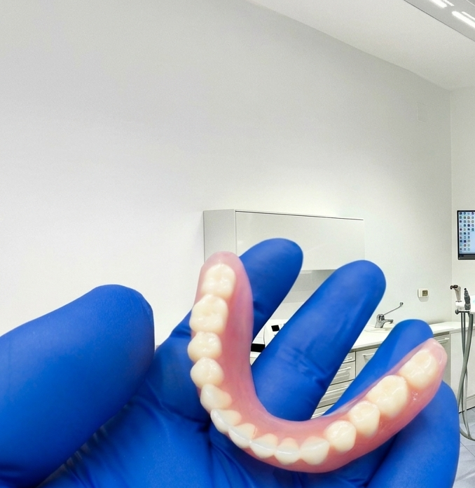 Una mano con un guanto medico blu regge una protesi dentaria sullo sfondo di uno studio dentistico.