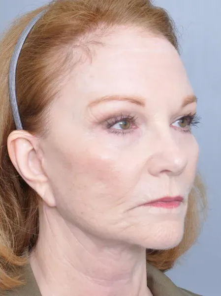 Woman's face in profile, with light skin, looking right, wearing a headband.