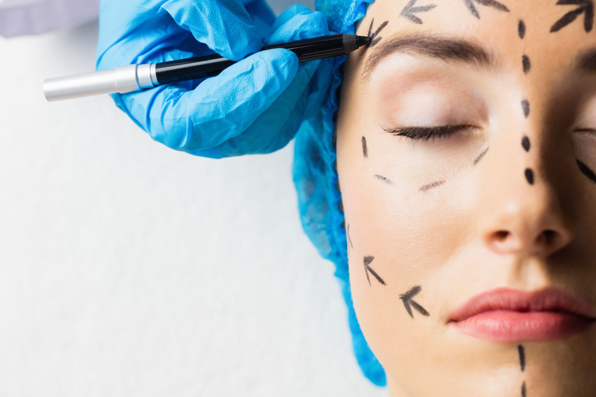 A healthcare professional in a blue surgical cap and gloves marks a patient’s face with a pen for cosmetic surgery.