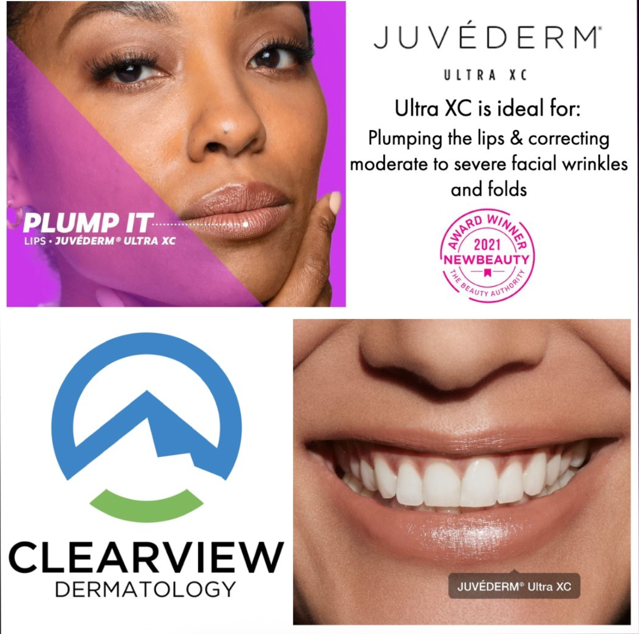 juvederm infographic