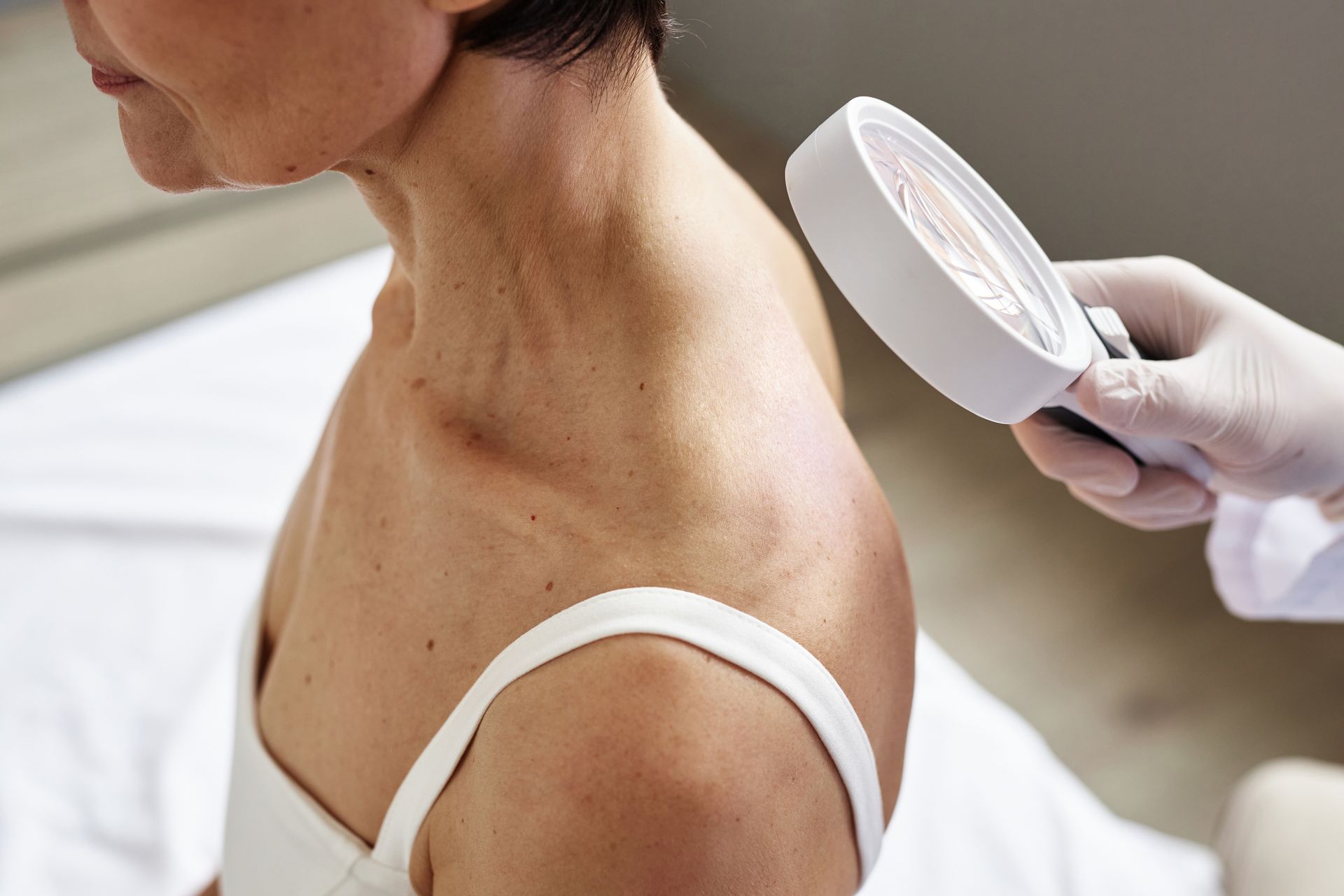 skin exam for skin cancer with magnifying glass arvada co