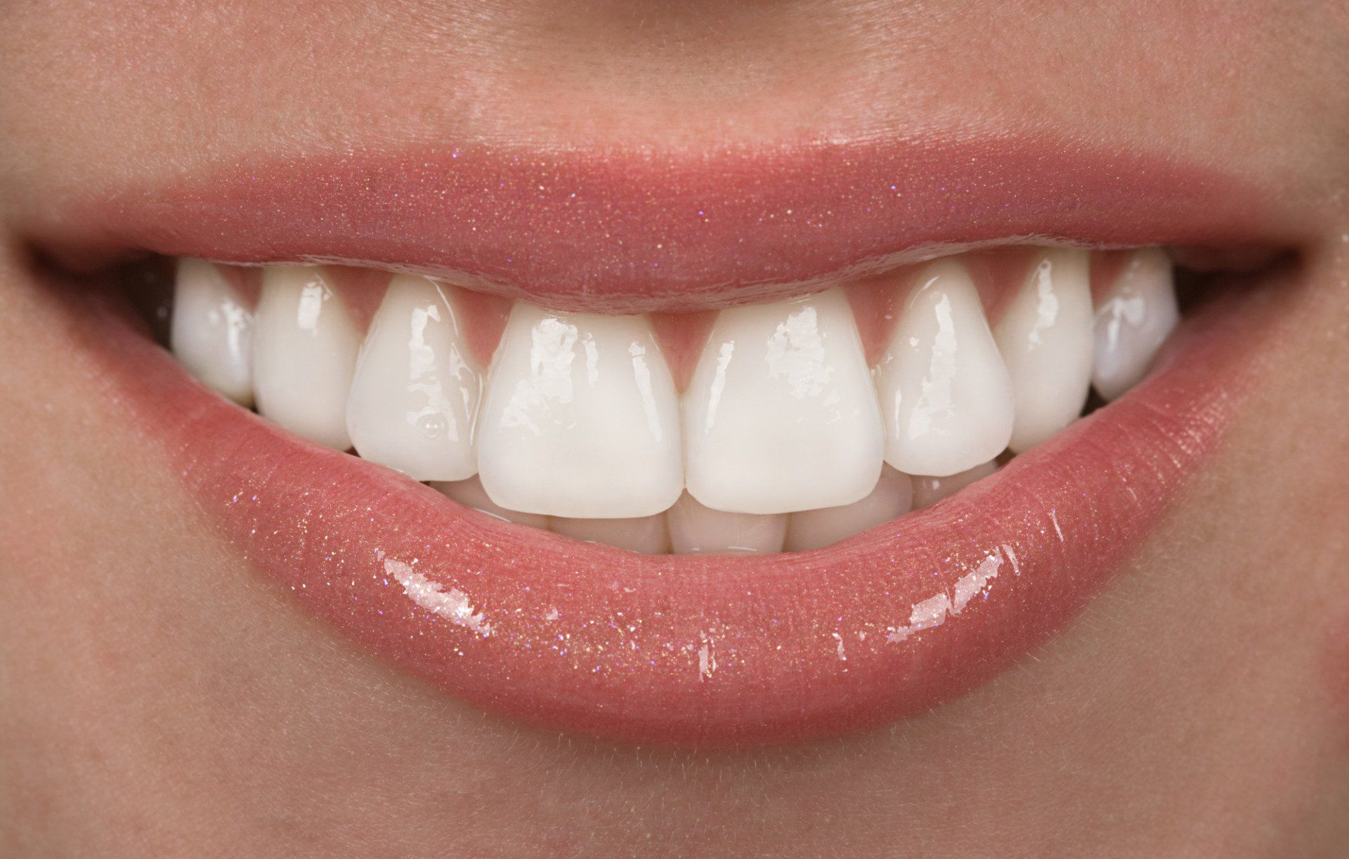 teeth with composite veneers