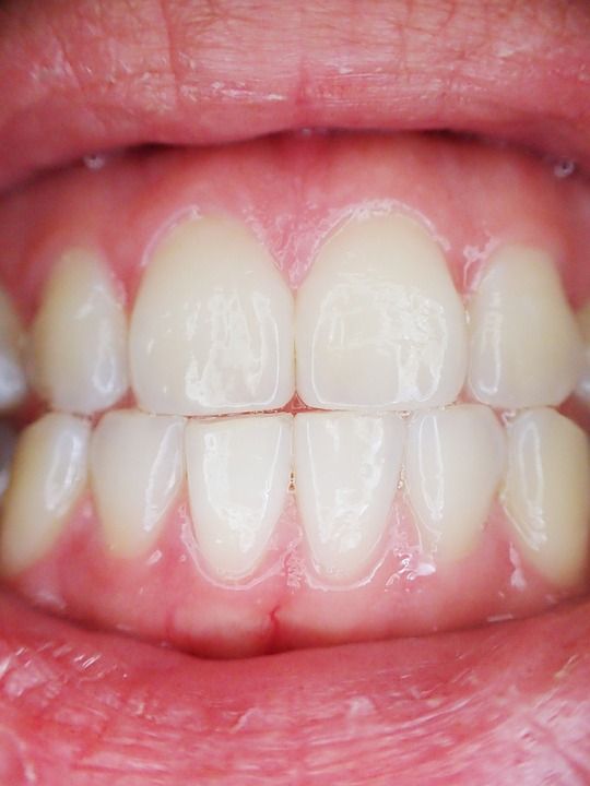 Advanced Gum Disease
