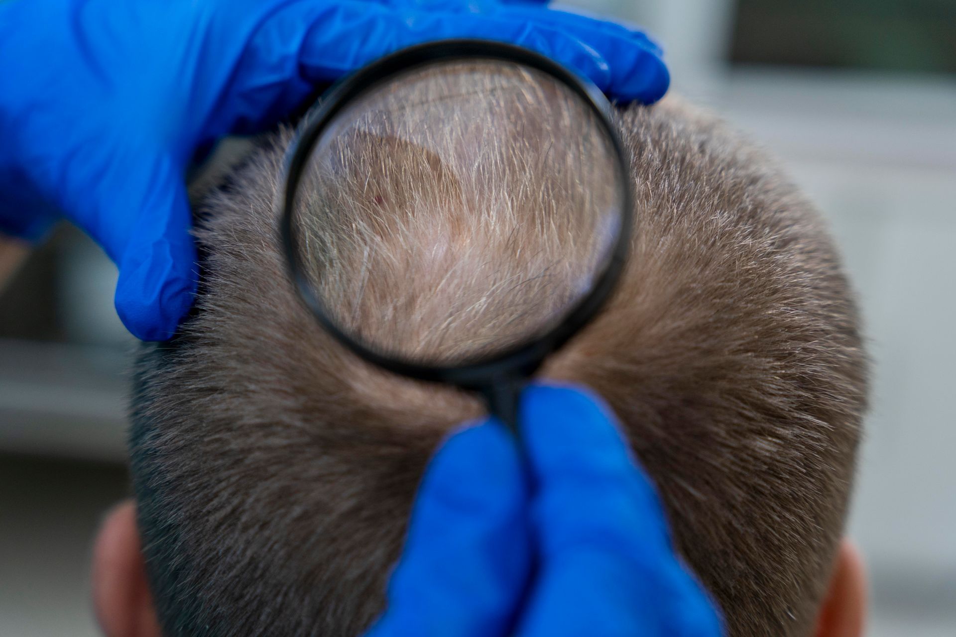 A man is looking at his hair through a magnifying glass.