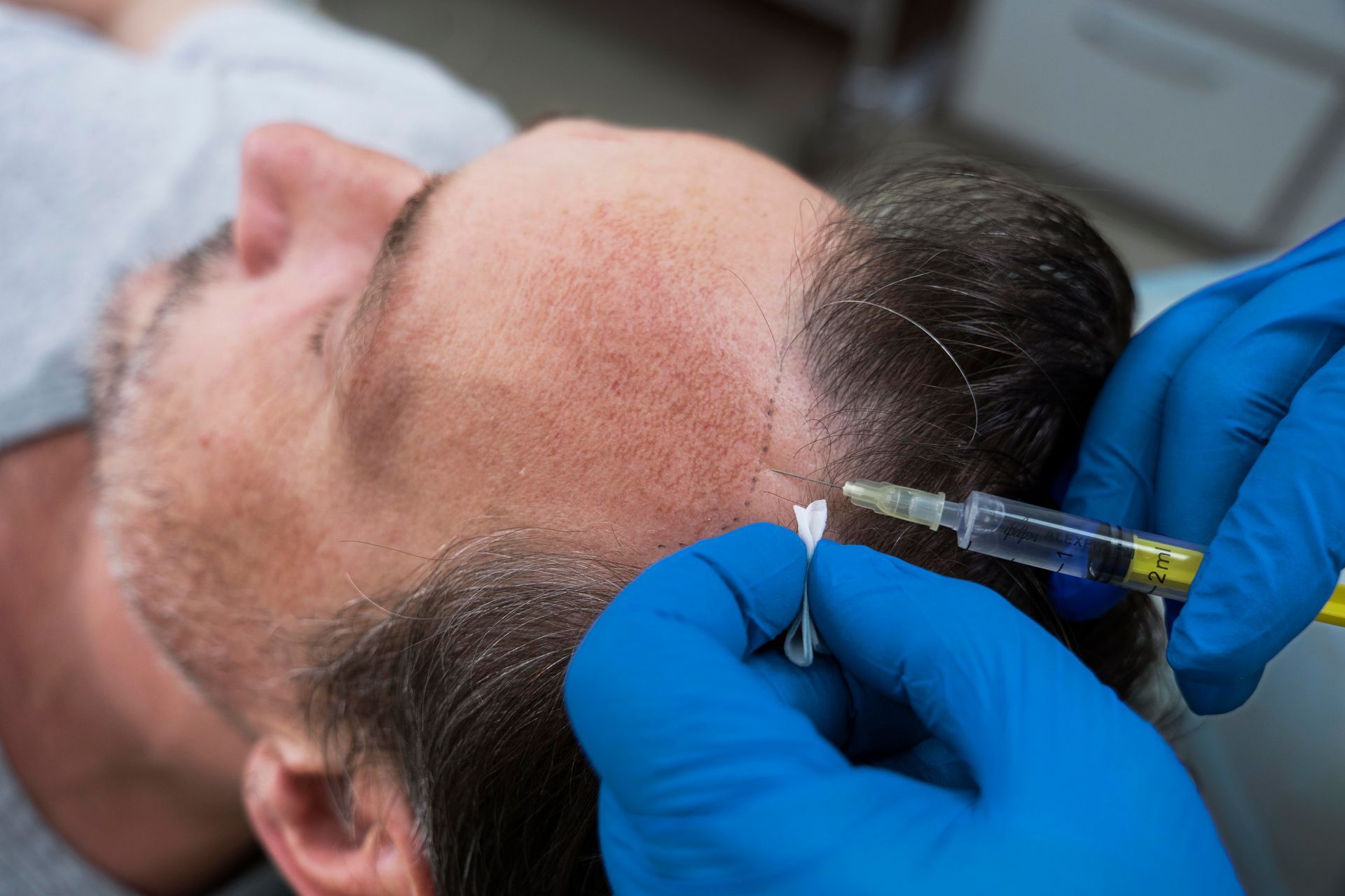 A man is getting an injection in his head by a doctor.