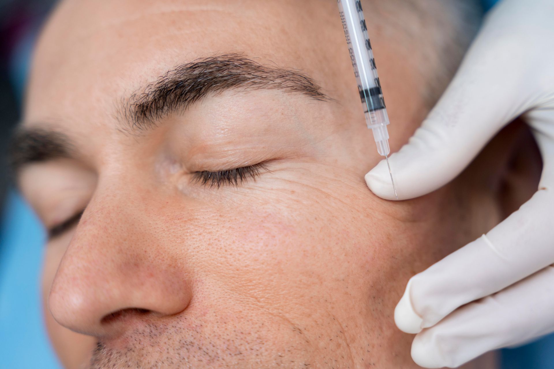 a man getting a prp cosmetic treatment