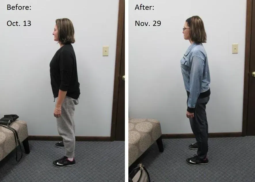 Side-by-side comparison of a person's posture before (Oct. 13) and after (Nov. 29) treatment, in a room.
