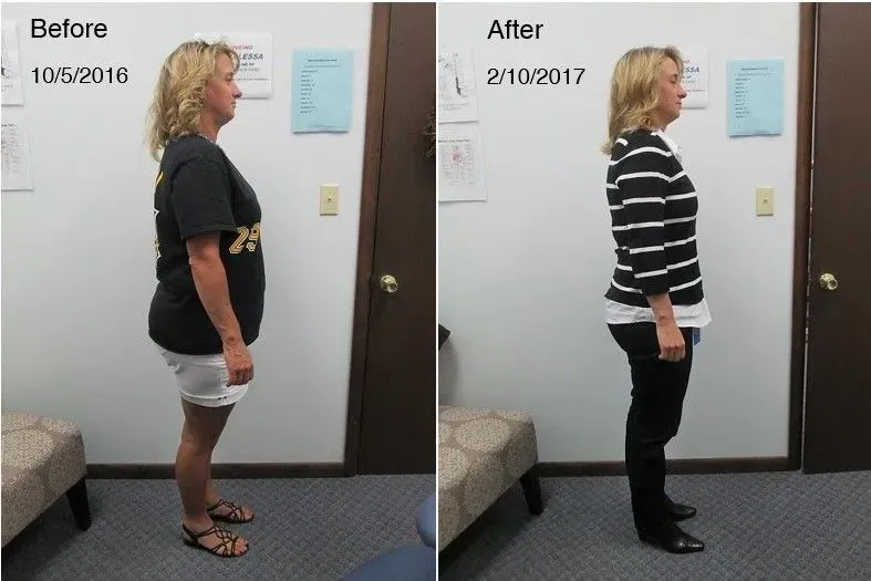 Side-by-side comparison of a person before and after: 10/6/2016 vs. 2/10/2017. Improved posture and weight loss.