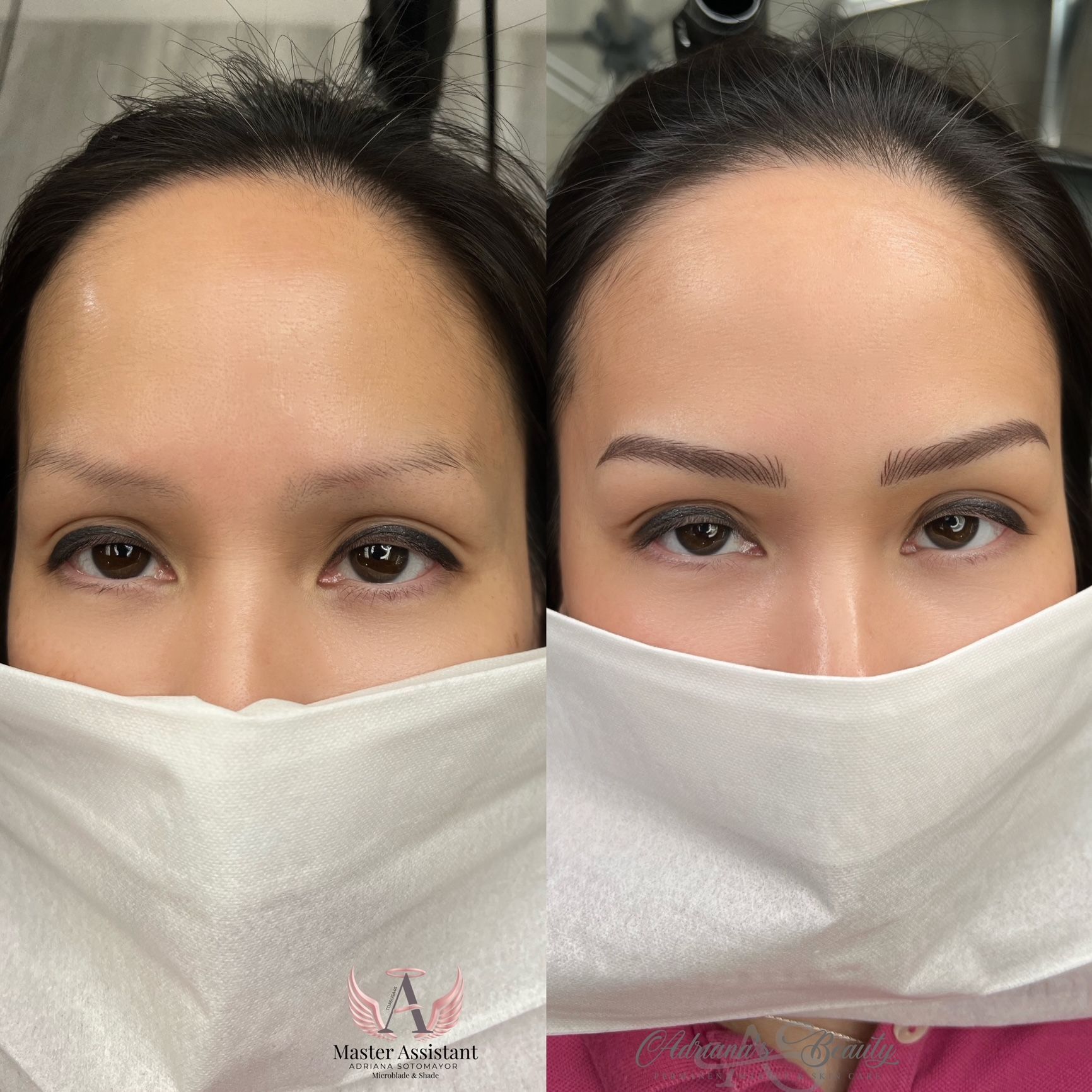 Before and after photos of a woman's eyebrows; the right side shows microblading.