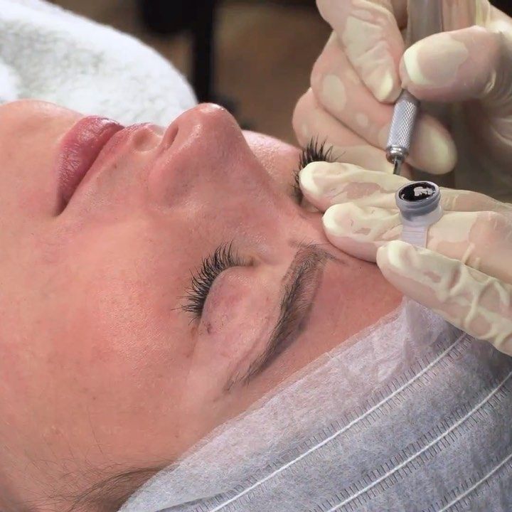 Woman receiving microblading on her eyebrow, performed by a gloved technician.